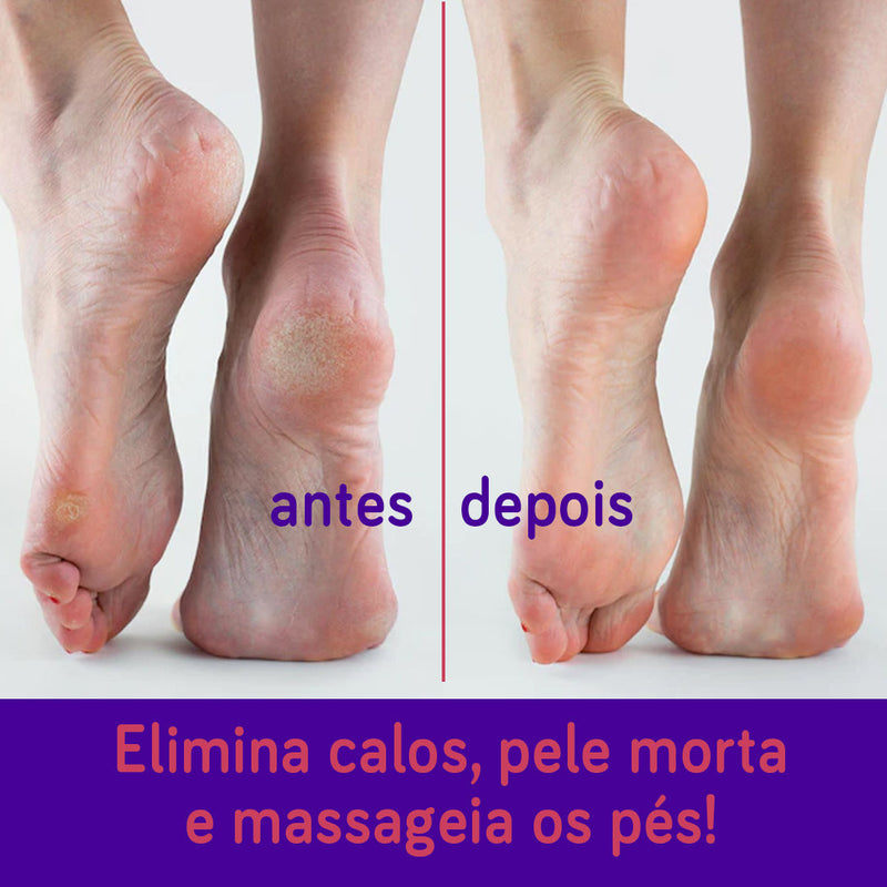 Lixa para Pés Bonitos e Saudáveis - Pedicuro Velvety Feet