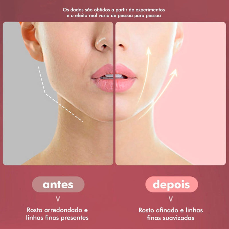 Massageador Facial para Queima de Gordura - Slim Face